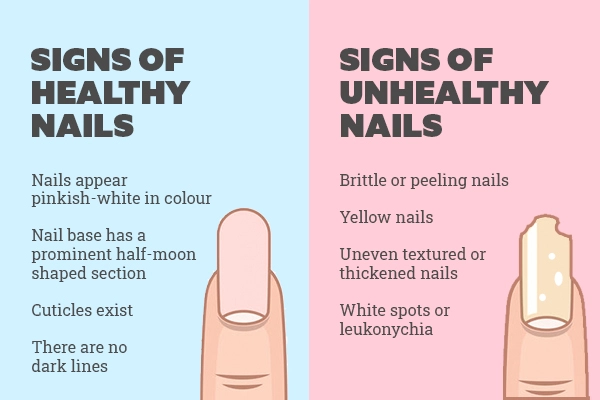 Best way to keep your Nails your Healthy and Shining